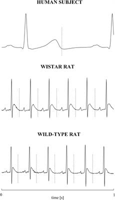 Concomitant Evaluation of Heart Period and QT Interval Variability Spectral Markers to Typify Cardiac Control in Humans and Rats